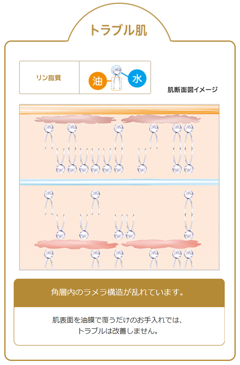 健康肌とトラブル肌の違い