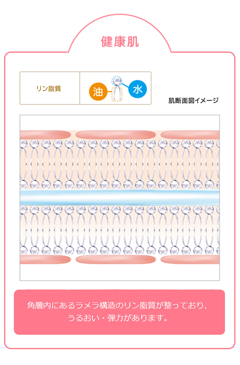 健康肌とトラブル肌の違い